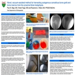 Most viewed ePoster at AOFAS annual meeting 2018!!